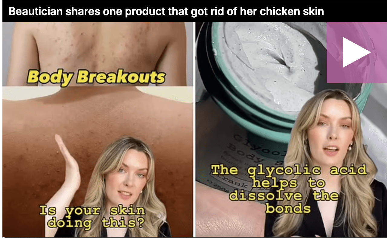 Shopper shares her $25 ‘secret’ and how it finally got rid of her back breakouts, ingrown hair and ‘chicken skin’